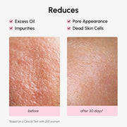 Maree Hydrating Pore Refining Toner White Smoke 1 item - Complete your routine,2 items - Good choice,3 items - Best price