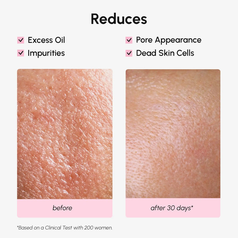 Maree Hydrating Pore Refining Toner White Smoke 1 item - Complete your routine,2 items - Good choice,3 items - Best price