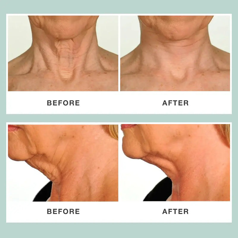 Contours Rx Neck Rescue Neck Firming Treatment White Smoke 1 Pack,2 Packs,3 Packs
