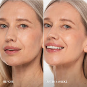 Maree Pro-Retinol Neck Lifting Cream Massager Dark Salmon 1 item - Complete your routine,2 items - Good choice,3 items - Best price