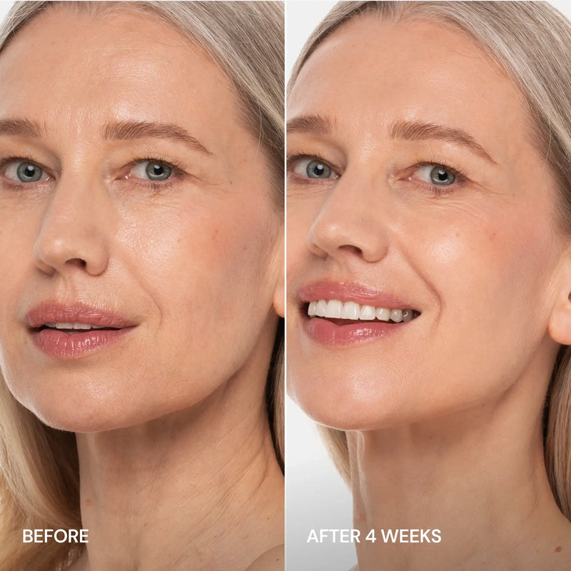 Maree Pro-Retinol Neck Lifting Cream Massager Dark Salmon 1 item - Complete your routine,2 items - Good choice,3 items - Best price