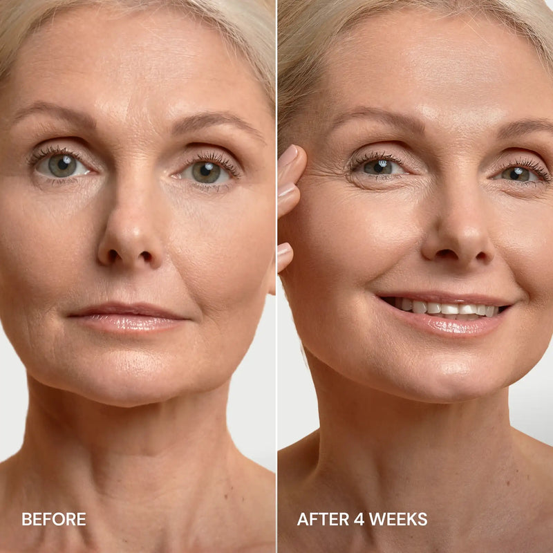 Maree Pro-Retinol Neck Lifting Cream Massager Rosy Brown 1 item - Complete your routine,2 items - Good choice,3 items - Best price