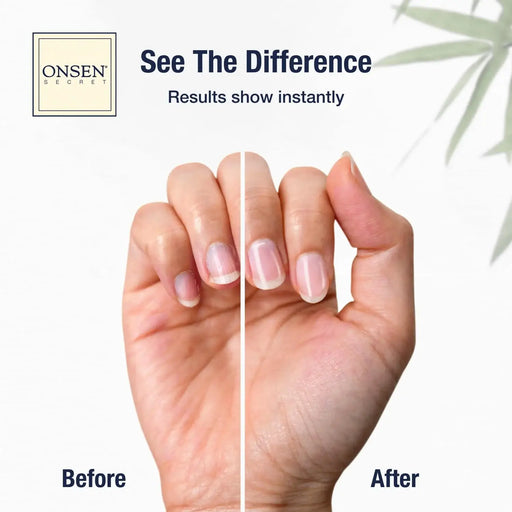 Onsen Secret Essential Nail Reboot Kit (Oil) Nail Kit Antique White Nail Reboot Kit