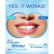 MySmile Teeth Whitening Pen w/ 35%CP Teeth Whitening White Smoke