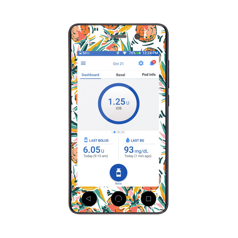 Peelz Pineapple Paradise Sticker for Omnipod DASH® PDM – Pump Peelz Peelz/Stickers White Smoke Whole System Peelz (front + case),Front Peelz