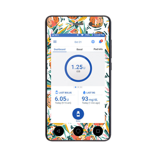 Peelz Pineapple Paradise Sticker for Omnipod DASH® PDM – Pump Peelz Peelz/Stickers White Smoke Whole System Peelz (front + case),Front Peelz
