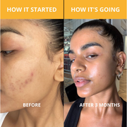 TUMERI Glow Skincare Bundle Health & Beauty Goldenrod