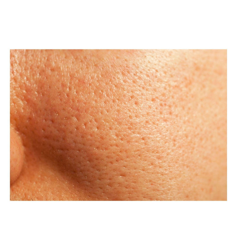 gymsegbë Thick As Thieves Pure Glycolic Acid Lactic Acid Extreme Gel Peel - 30ml Exfoliation, Dark Spots, Hyperpigmentation Navajo White 1 bottle,2 Bottles Save $0.99,3 Bottles Save $3.98,4 Bottles Save $11.97