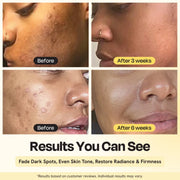Gleamin Superactive Serum Face Serum Seashell