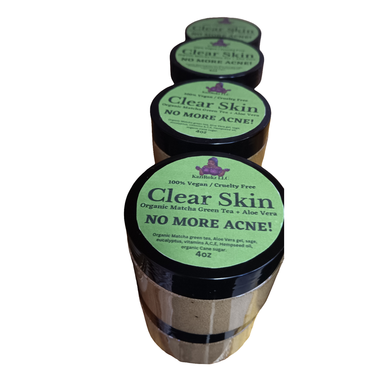 KaziRokz Organic Matcha Green Tea + Aloe Vera Acne Treatment/ Clear Skin Treatment (100% Vegan/CrueltyFree) 4oz Dark Slate Gray