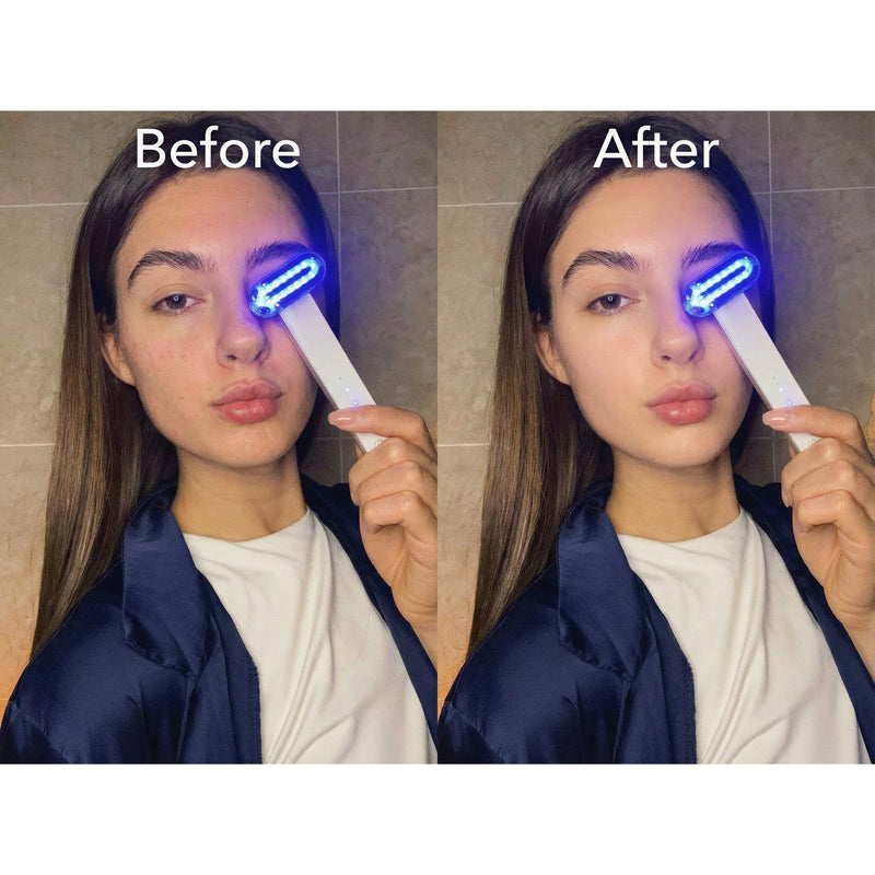ZAQ Skin & Body ZAQ Zayn 2.0 — 6-in-1 LED & Microcurrent Facial Wand Rosy Brown