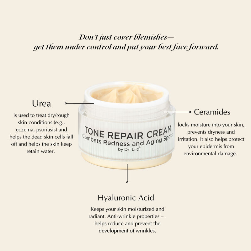 EpiLynx Brightening Tone Repair Cream for Dark Spots & Uneven Skin – Vegan & Gluten-Free Face Creams Beige