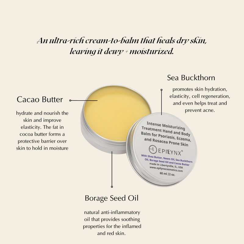 EpiLynx Velvet Hydration Body Balm – Ultra-Rich, Vegan, Gluten-Free Moisture for Dry & Sensitive Skin moisturizer Antique White