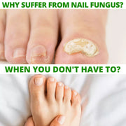 COLEHERBALS LLC 12 - Dr. Cole's Nail Fungus Balm Herbal Lavender