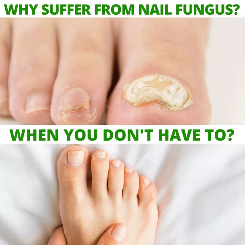 COLEHERBALS LLC 12 - Dr. Cole's Nail Fungus Balm Herbal Lavender