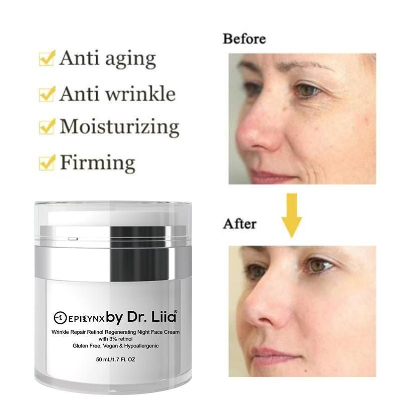 EpiLynx Wrinkle Repair Retinol Night Cream – Vegan, Gluten-Free, Regenerating Anti-Aging Moisturizer Face Creams White Smoke