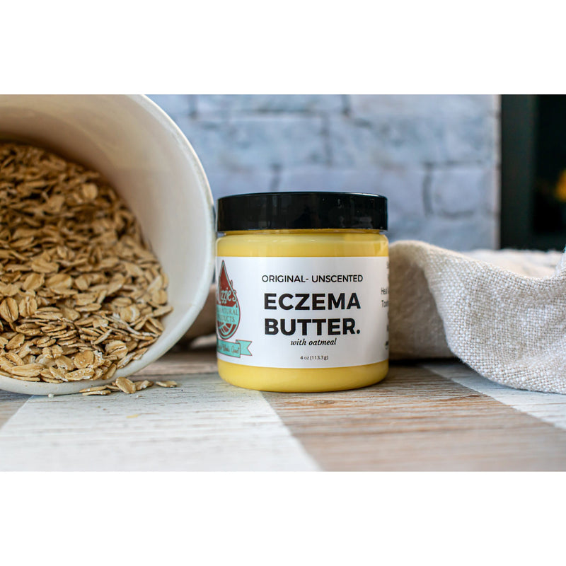 Lizzie's All-natural Products Lizzies All Natural Eczema Butter Gray Original-Unscented / 2 ounce travel size,Lavender-Chamomile / 2 ounce travel size,Original-Unscented / 4 ounce,Original-Unscented / 8 ounce,Lavender-Chamomile / 4 ounce,Eucalyptus-Chamomile / 4 ounce,For Babies / 4 ounce