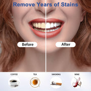 MySmile Teeth Whitening Gel Refill w/ 18% CP Teeth Whitening Rosy Brown
