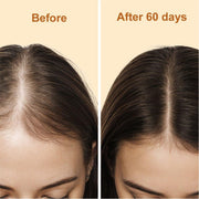 yoni rescue Hair Growth Oil Hair Oil Bisque