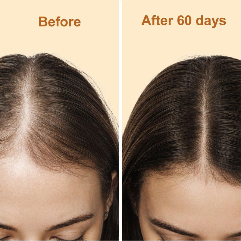 yoni rescue Hair Growth Oil Hair Oil Bisque