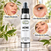 Lulu’s Holistics Lulu's Holistics Clarifying Witch Hazel & Tea Tree Blemish Face Mist (4oz) Gray Acne / 1-Bottle,Acne / 2-Pack,Acne / 3-Pack,Anti-aging / 1-Bottle,Anti-aging / 2-Pack,Anti-aging / 3-Pack