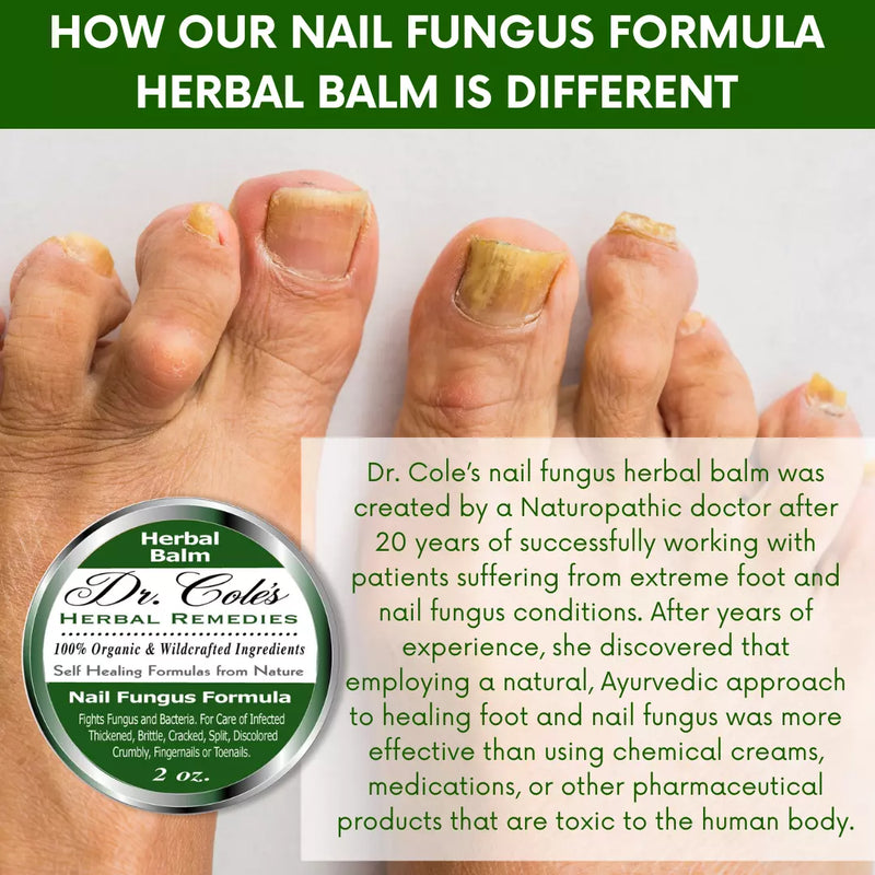 COLEHERBALS LLC 12 - Dr. Cole's Nail Fungus Balm Herbal Lavender
