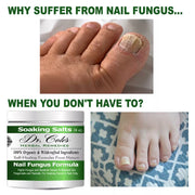 COLEHERBALS LLC 13 - Dr. Cole's Organic Nail Fungus Salts Formula Herbal White Smoke