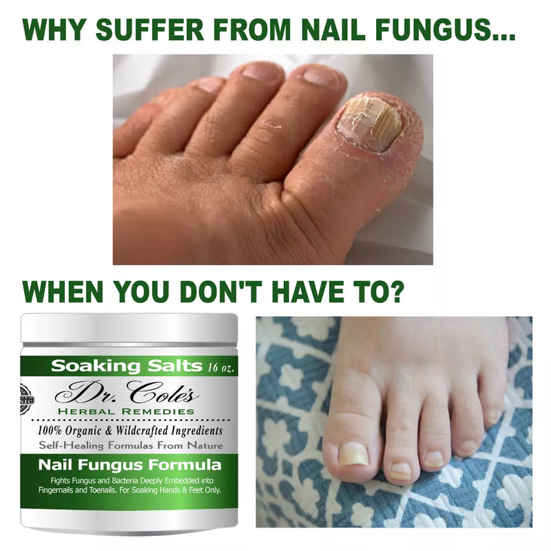 COLEHERBALS LLC 13 - Dr. Cole's Organic Nail Fungus Salts Formula Herbal White Smoke