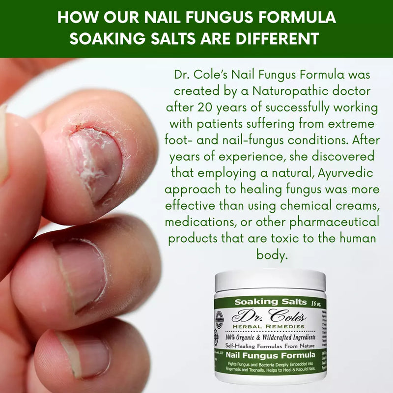COLEHERBALS LLC 13 - Dr. Cole's Organic Nail Fungus Salts Formula Herbal Lavender