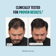 Nava Beauty Nutrafol Men's Hair Growth Supplement 3-Month Supply Powder Blue