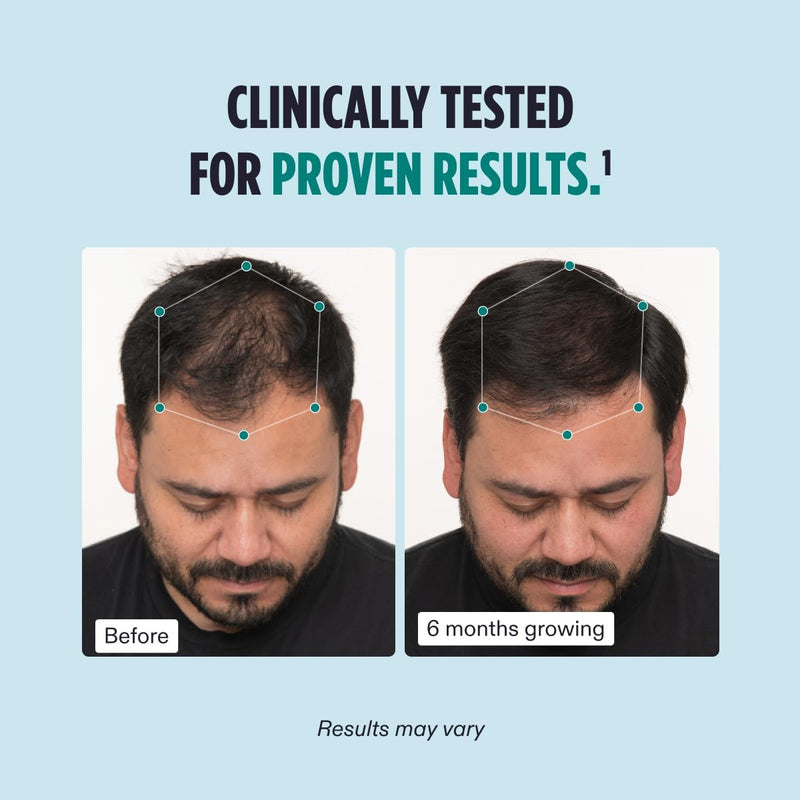 Nava Beauty Nutrafol Men's Hair Growth Supplement 3-Month Supply Powder Blue