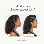Nava Beauty Nutrafol Women's Vegan Hair Growth Supplement Pack 3-Month Supply White Smoke