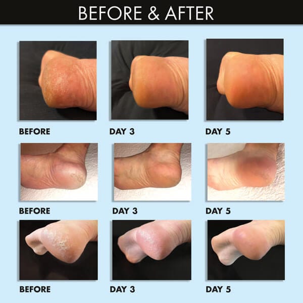 whish beauty Coconut Milk + Verbena Exfoliating Foot Mask Body Care > Exfoliators > Foot Mask Black
