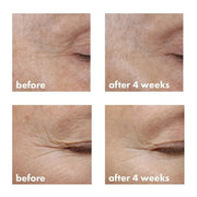 whish beauty Revitalizing Eye Cream with Bakuchiol - New and Improved! Skin Care > Eye Treatment Rosy Brown