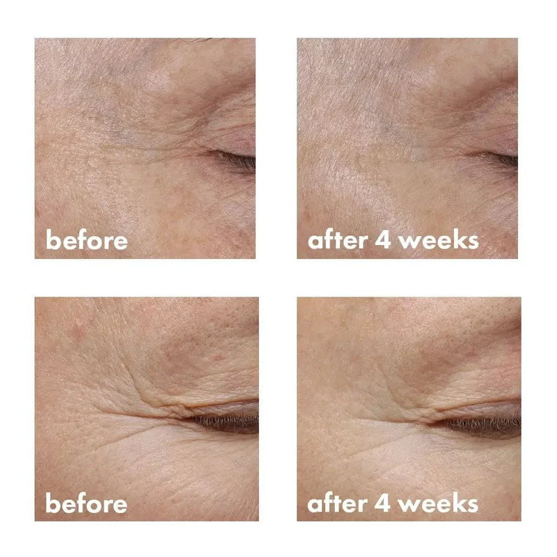 whish beauty Revitalizing Eye Cream with Bakuchiol - New and Improved! Skin Care > Eye Treatment Rosy Brown